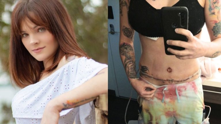 Mujer fue por cirugía para una reducción mamaria: Despertó con implantes y una liposucción