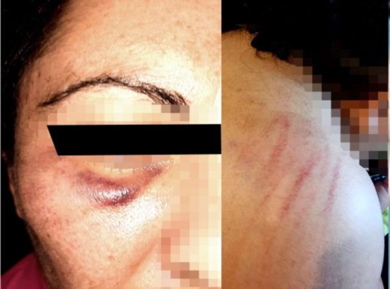 Independencia: Denuncian ataque a pareja lésbica y a sus mascotas con golpes de pies, puños y palos