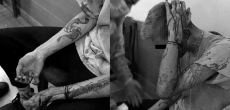 Golpes de puños y patadas: Movilh denuncia violento ataque homo transfóbico a jóvenes en restaurante de Providencia