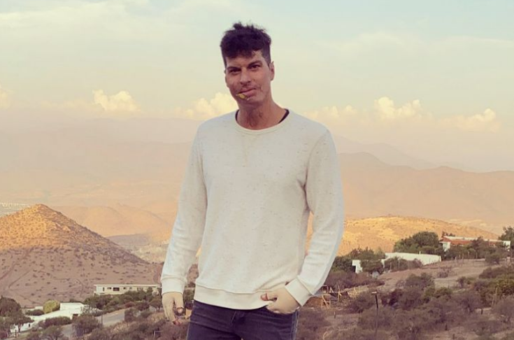 Ignacio Lastra recordó su grave accidente con foto de su auto quemado: 