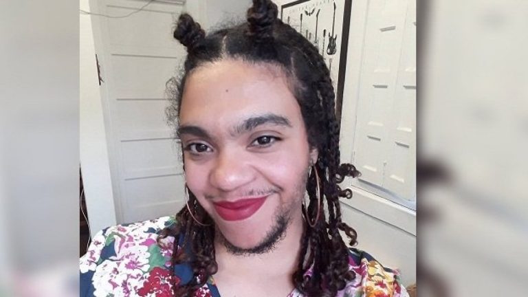 ¡Desafió estereotipos! Chilena compartIó en redes sociales su proceso de aceptación con barba