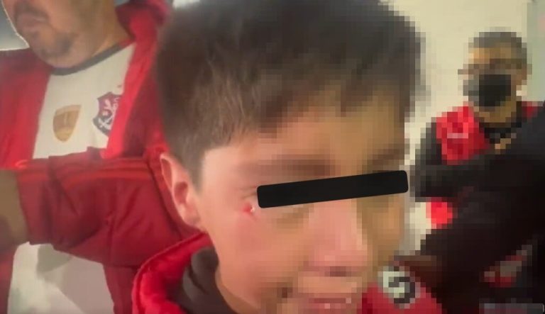 Madre de niño agredido con bengala por hinchas de la UC: 