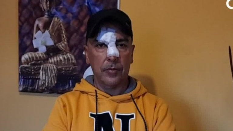 Busca justicia: Hombre fue víctima de brutal golpiza al ser confundido con un delincuente