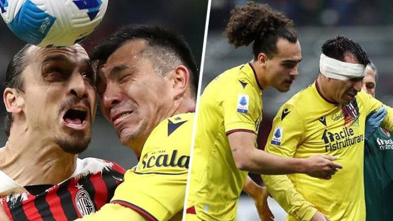 ¡Impactante! Así quedó Gary Medel tras choque con Zlatan Ibrahimovic