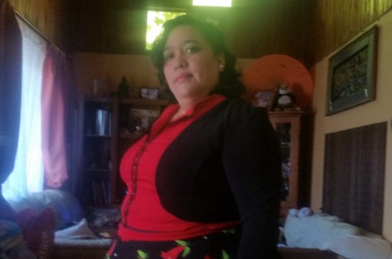 Pide traslado: El calvario de folclorista de Limache que quedó con graves secuelas tras cirugía por quistes