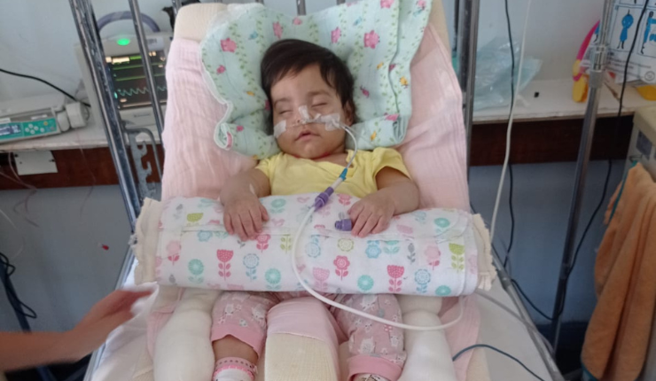 Fuera del sistema: La lucha diaria de la madre de la primera niña con un raro síndrome en Chile