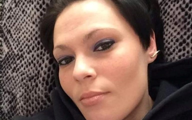 Mujer perdió su mandíbula y ahora luce 40 años mayor: Todo comenzó con la extracción de un diente