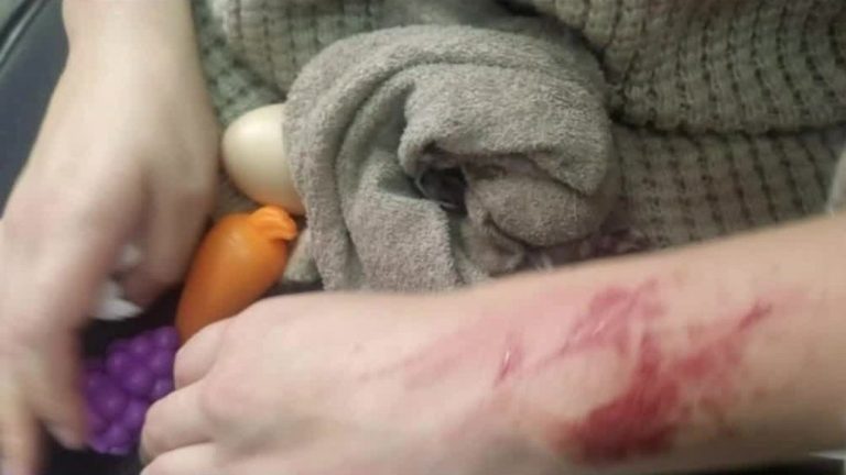 Un viaje de pesadilla: Chofer de aplicación intentó secuestrar a una mujer con su hija autista; le cortó los brazos