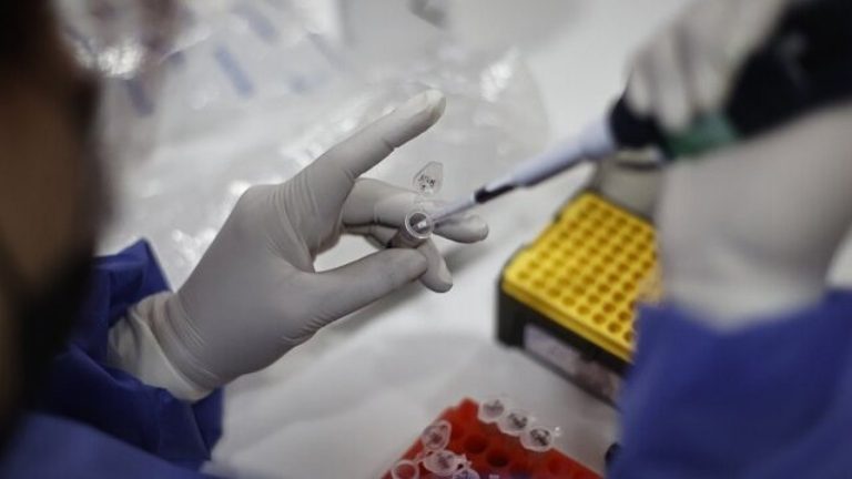 Último minuto: Minsal confirmó primer caso de viruela del mono en Chile