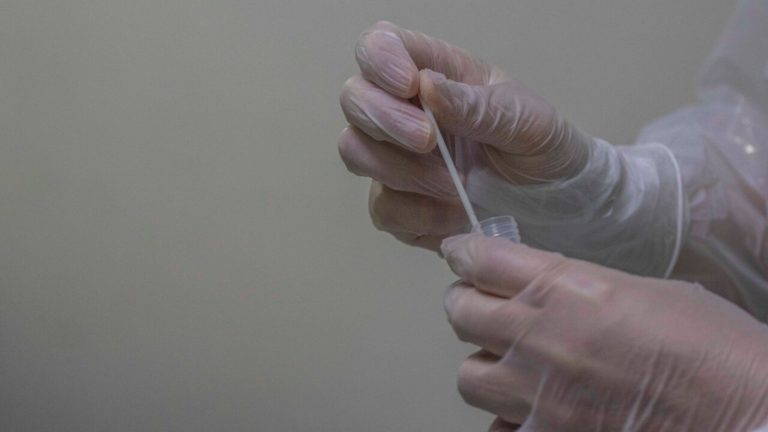 Confirman segundo caso de viruela del mono en Chile: Corresponde a un adulto de La Araucanía