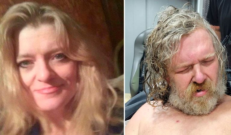 Mujer despertó de un coma en EE.UU. tras brutal ataque y reveló quién la golpeó: Su hermano fue arrestado