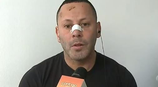 La pesadilla del coreógrafo Jaime Nahum tras severa golpiza: 