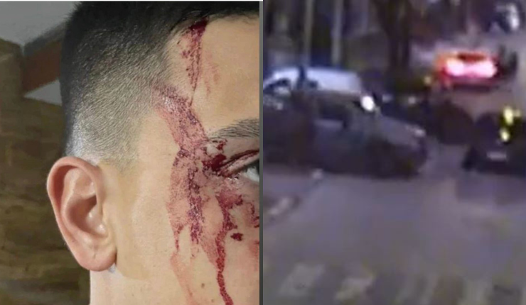 Terminó con el rostro ensangrentado: Futbolista de Boca Juniors sufrió violenta encerrona a metros de su casa