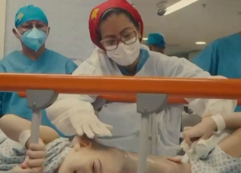 Duró 27 horas: Siameses unidos por el cerebro fueron separados tras intervención con realidad virtual