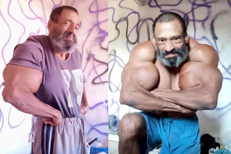 Presentó dificultad al respirar: Fisicoculturista habría muerto al inyectarse una sustancia para los músculos