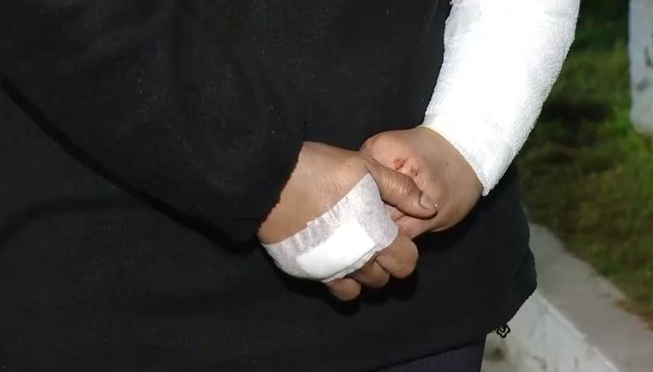 Niña de 5 años en riesgo vital tras ser mordida por dos perros rottweiler en La Reina