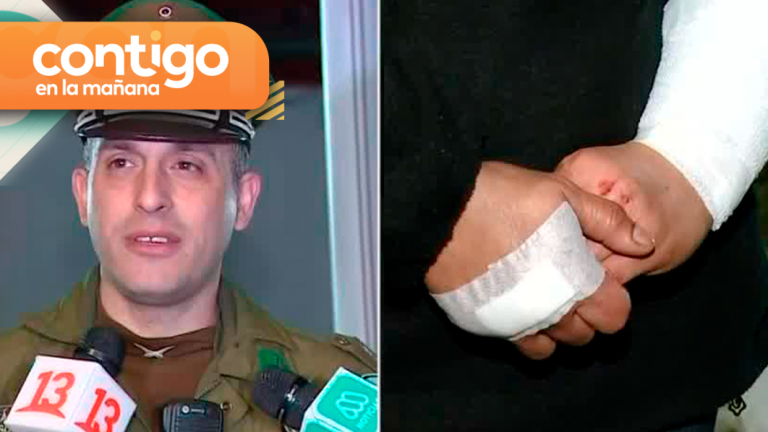 El portón habría quedado abierto por un auto: Se investigan las causas de la grave mordedura de dos rottweilers a niña de 5 años