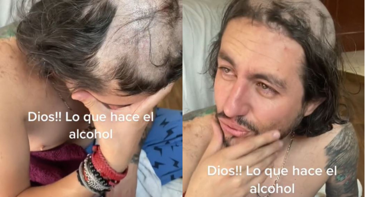 Hijos aprovecharon que su padre dormía tras beber alcohol y le hicieron el peor corte de pelo