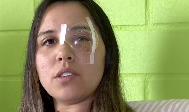 El dramático relato de mujer tras ataque con piedra en auto: 