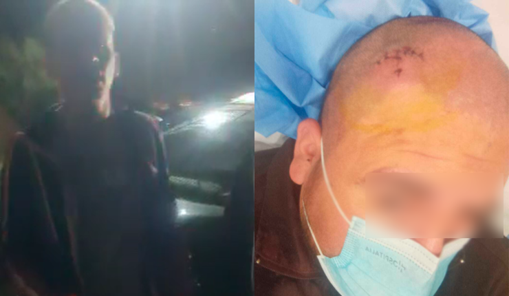 Grave denuncia contra volante de la U Pablo Aránguiz: Guardia asegura que lo agredió con objeto contundente