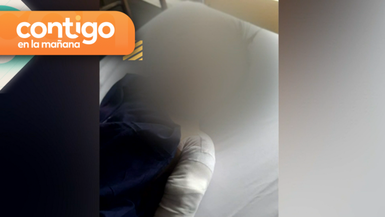 Niño de 3 años casi pierde el brazo tras se atacado por el perro de un vecino