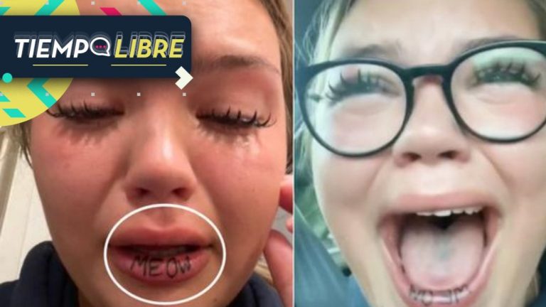 Joven lloró luego de ver cómo quedó un tatuaje que se hizo en la boca