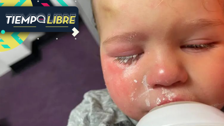 Horror en jardín infantil: Niño terminó en el hospital luego de que cuidadora le salpicara pegamento para uñas en el ojo