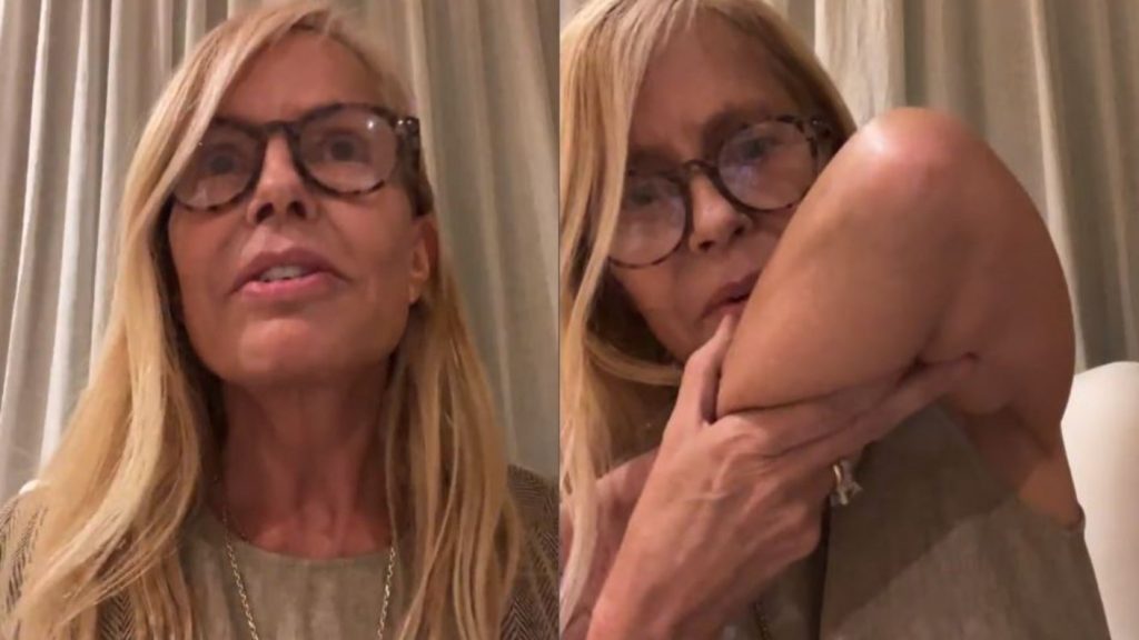 Me saqué la c…”: El accidente que casi obliga a la suspensión de la boda de Cecilia  Bolocco