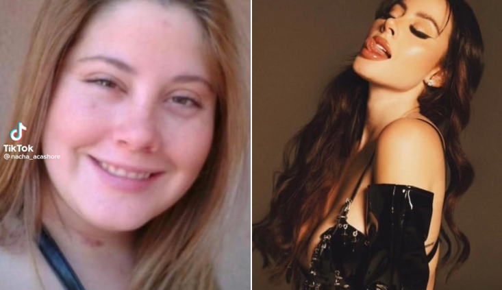 Ignacia Michelson reveló sus cirugías estéticas tras viral adolescente en TikTok: 