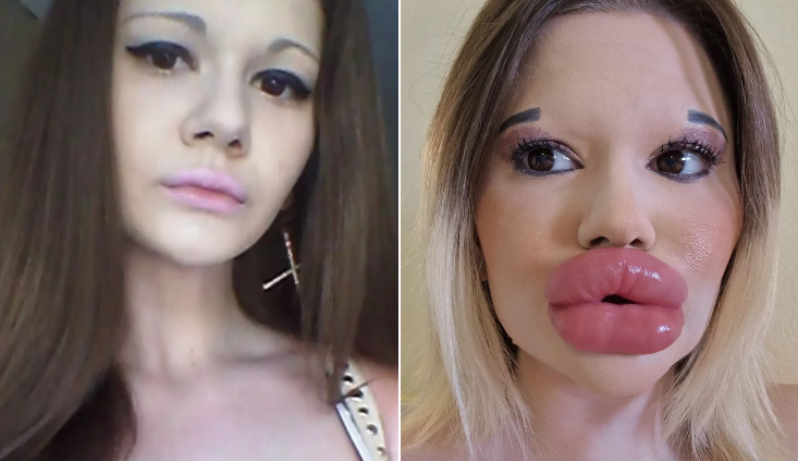 Médico le pidió que pare: Impacto por joven que busca tener 