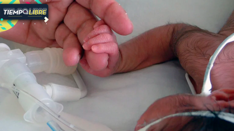 ¡Impactante! Reportaron el nacimiento de un bebé con una cola de casi 6 centímetros de largo