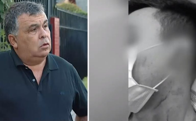 Joven en riesgo vital tras brutal golpiza en discoteque de Las Condes: Lo atacaron con un fierro en la cabeza