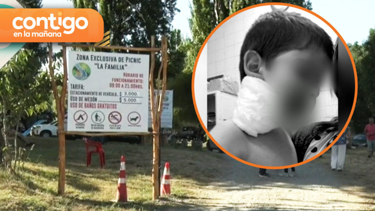 Niño de dos años fue atacado por un perro en camping: Quedó con heridas en su cara y cabeza