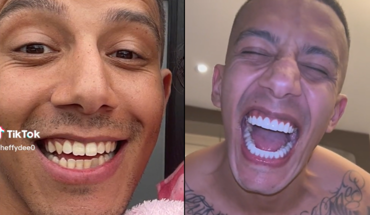 Pagó más de $3,6 millones: Tiktoker se hizo especial tratamiento dental, pero resultado no gustó a seguidores