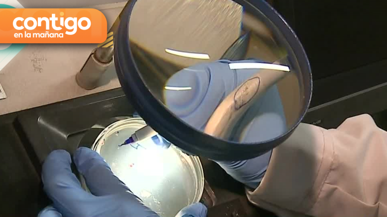 Escherichia coli: Fecas y otras bacterias que fueron encontradas en comidas callejeras