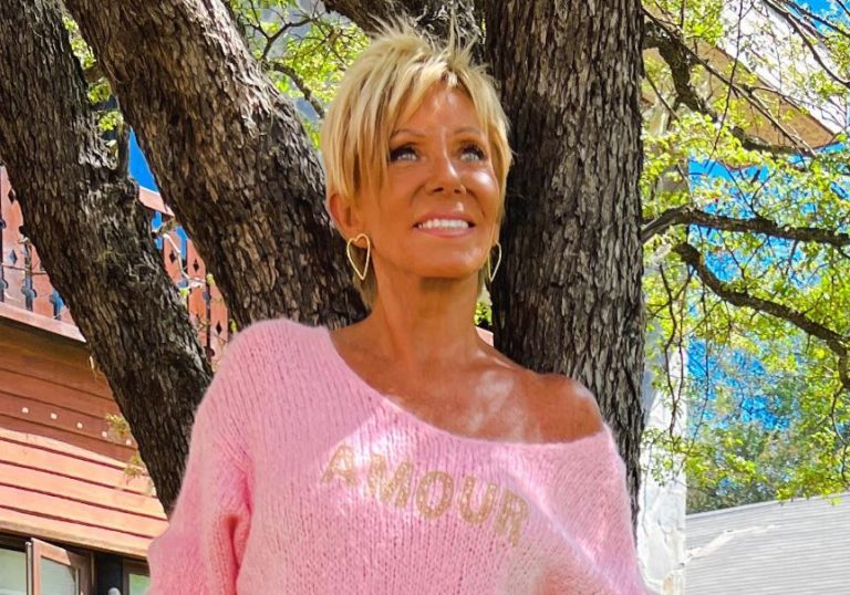 Raquel Argandoña reveló los detalles de su rejuvenecimiento facial: 