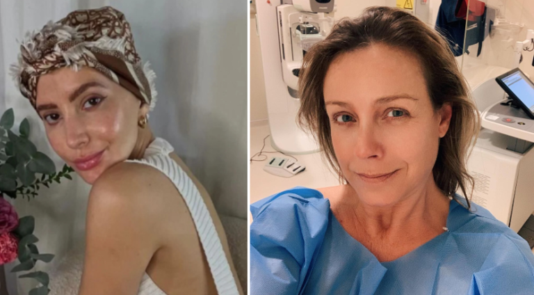 Aylén Milla y Claudia Conserva lo padecen: Qué es y cómo detectar el cáncer de mama triple negativo