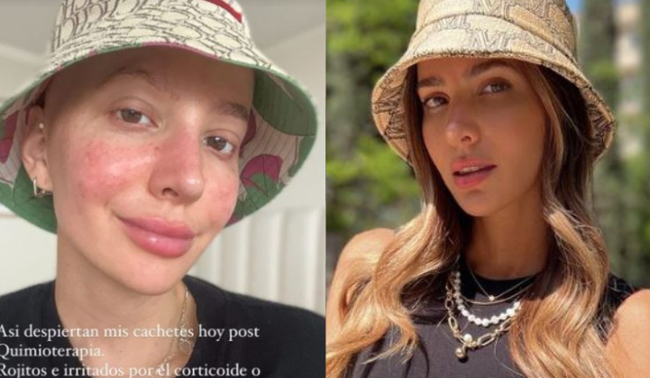 Aylén Milla comparte primera foto post quimioterapia por cáncer con íntimo mensaje: 