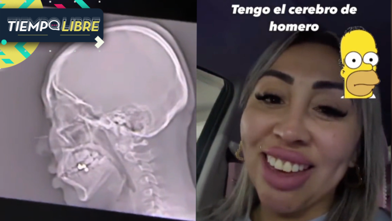 “Tengo el cerebro de Homero”: Naya Fácil sacó carcajadas al interpretar resultados de su examen