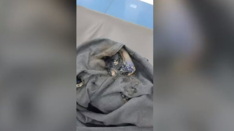 Celular explotó en el bolsillo de un escolar en plena clase: Quedó con un hematoma y quemaduras en sus manos