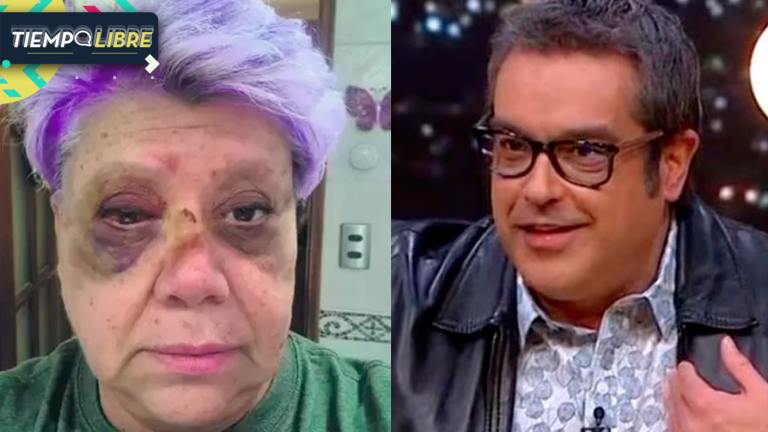 Paty Maldonado respondió sin filtro a la acusación de Manu González tras accidente: “La gente dice cosas…”