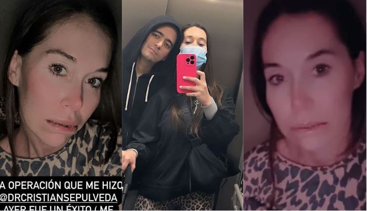 “Me daba vergüenza y pudor mostrar...”: Vale Roth reveló grave problema de salud que la obligó a operarse