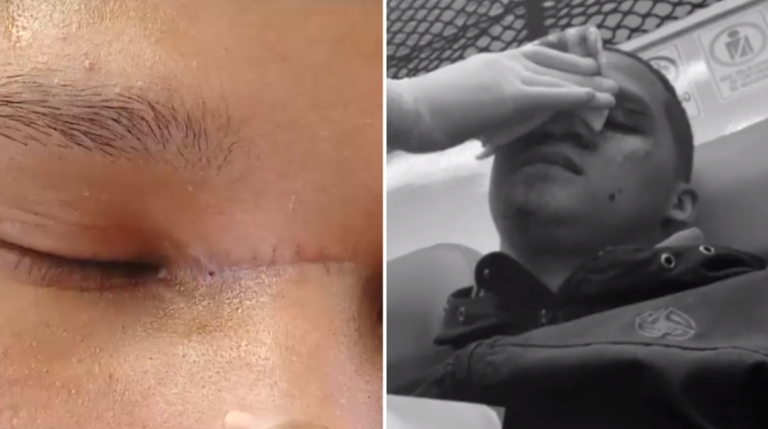 Motoristas inician campaña en contra del hilo curado para evitar devastadoras consecuencias