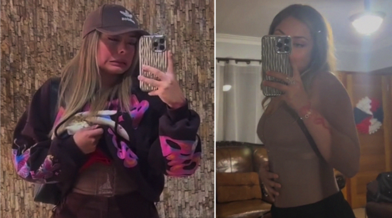 Skarleth Labra mostró el antes y después de su liposucción a horas de volver a Gran Hermano