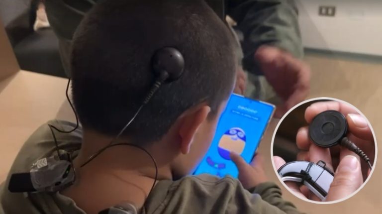 Alerta por implantes cocleares fallados: Pacientes tendrán que ser operados nuevamente