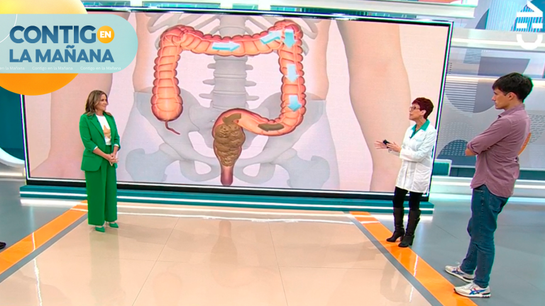 ¿Colon irritable o hinchazón? Doctora Carolina Herrera explicó la diferencia