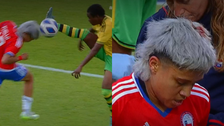 Tremendo: Fernanda Pinilla sufrió corte en la cabeza tras brutal patada de jugadora de Jamaica