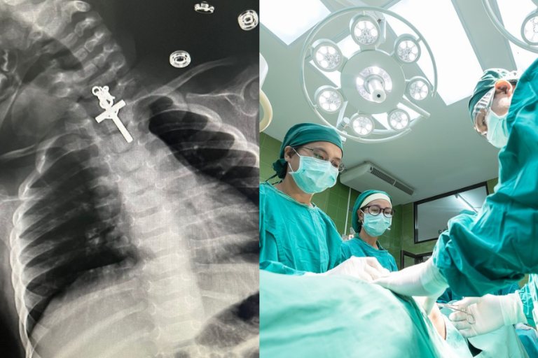 Médicos sacaron un crucifijo del esófago de una lactante: “Dios nos ha dado una oportunidad de vida