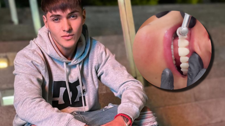 ¡Otro más! Hans Valdés mostró antes y después de importante cambio físico con efusiva sonrisa