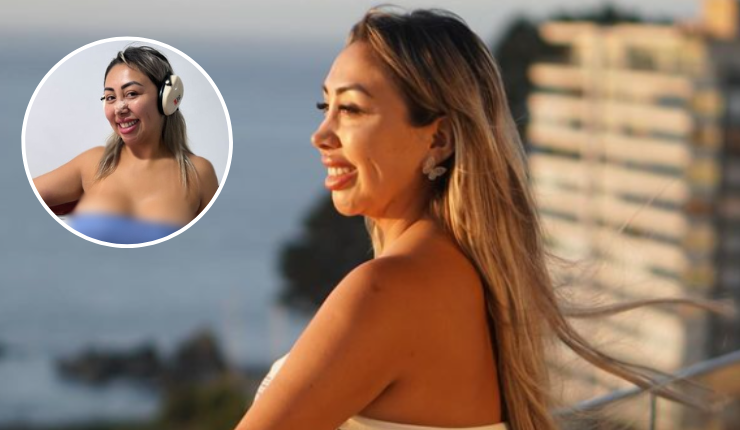 Naya Fácil mostró los resultados de su lipotransferencia a sólo 3 días de la intervención: 